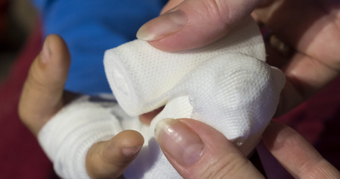 Dziecko z bostonką ma owijaną dłoń bandażem